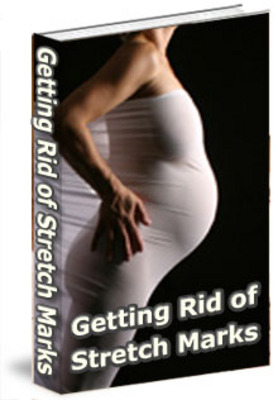 Product picture stretch marks MRR